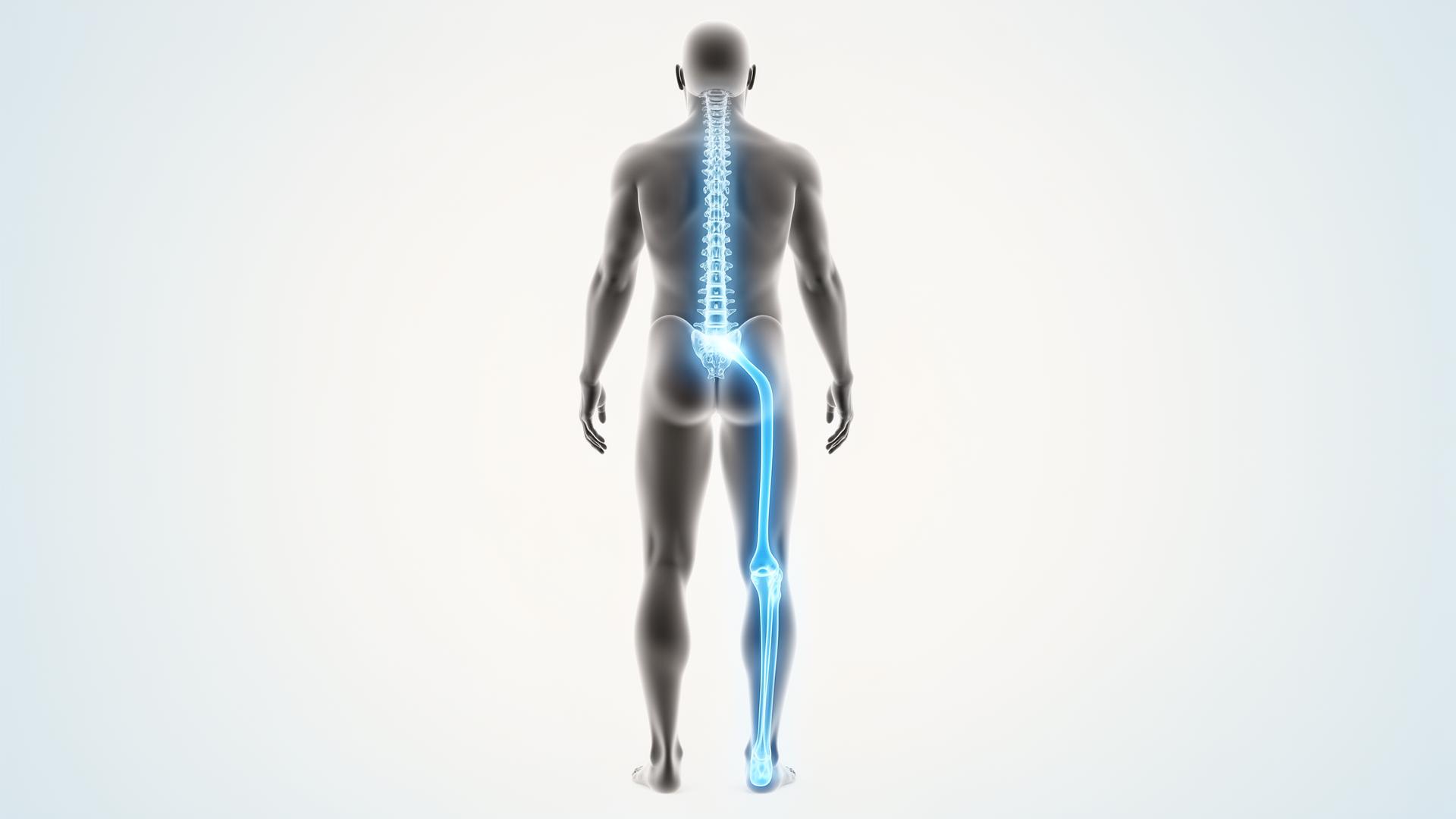 Sciatic nerve pathway illustration showing the path of the nerve from the lower back into the leg, BodyCare Sports Injury Clinic, Newmarket